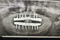 WhatsApp-Image-2023-07-20-at-13.11.23-1